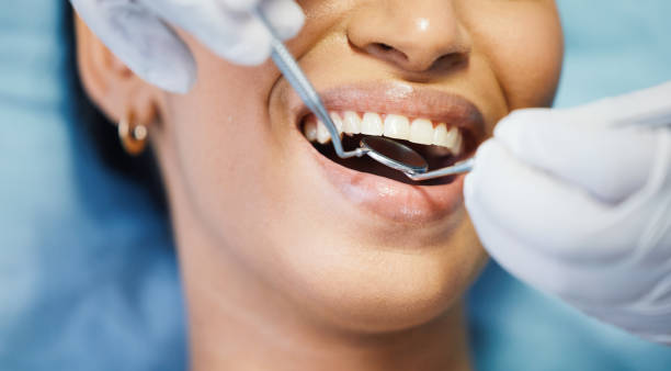 Best Emergency Dental Care for Abscessed Tooth in Oak Island, NC