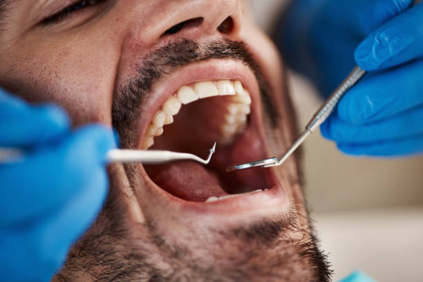 Best Weekend Emergency Dentist in Oak Island, NC